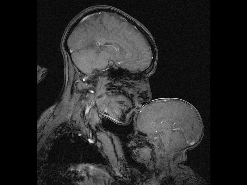 Scientists-reconfigured-a-magnetic-resonance-scanner-to-capture-a-woman-and-her-baby-MIT